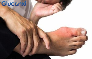 Tìm hiểu về bệnh gout là gì 