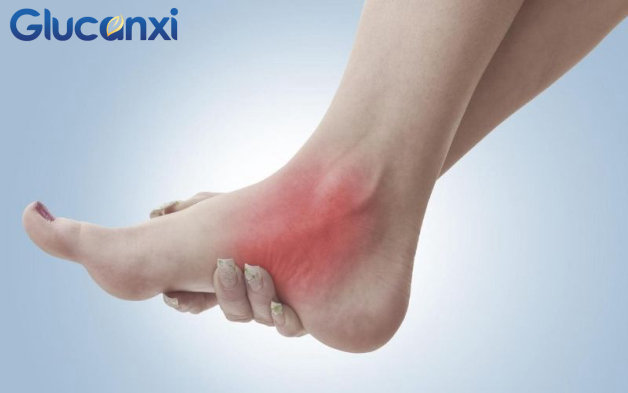Viêm mắt cá chân có nguy hiểm không? Dấu hiệu và cách điều trị