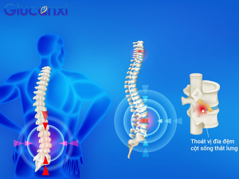 Ngồi lâu làm tăng áp lực lên cột sống, đặc biệt là vùng thắt lưng